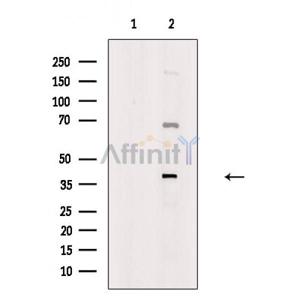 Валидация Affinity DF2494 - 13143