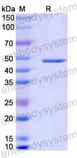 Валидация SDS-PAGE - AntibodySystem RVV13415