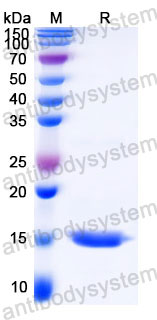 EHC39401, SDS-PAGE