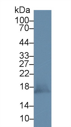 14747