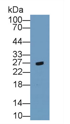 11974