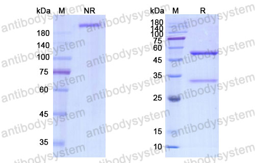Валидация SDS-PAGE - AntibodySystem DHE43205