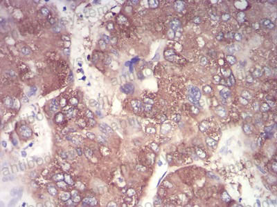 Валидация AntibodySystem RHD69005 (1719)