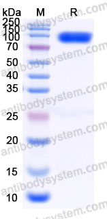 AHD47904, SDS-PAGE