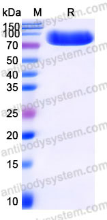 AHD30404, SDS-PAGE