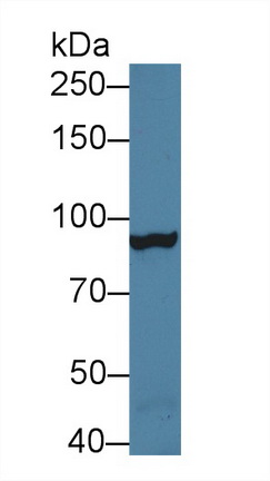 12704