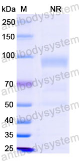 Валидация SDS-PAGE - AntibodySystem DHC27706