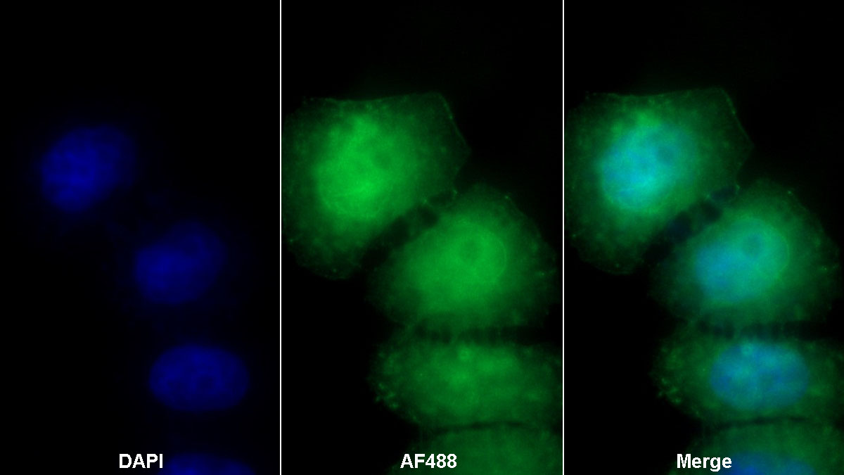 31514