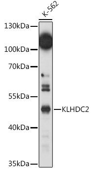 A15146, вестерн-блоттинг, лизат клеток K-562 (6250)