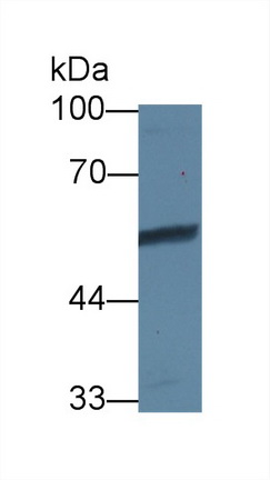 13652