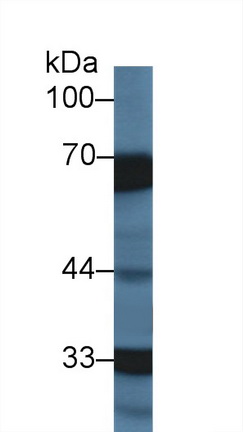 14360