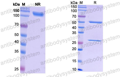 Валидация SDS-PAGE - AntibodySystem DHA94801