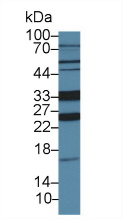 9985