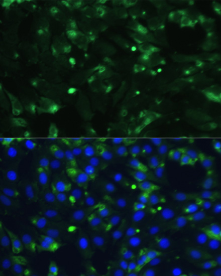 A16841, иммунофлуоресцентный анализ, клетки C6 (12373)