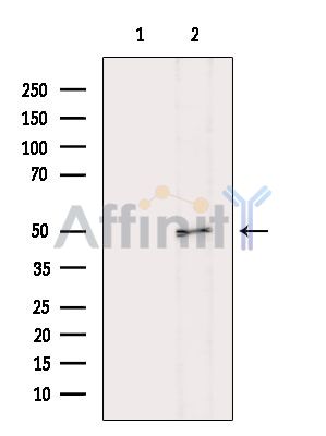 Валидация Affinity DF8502 - 20357