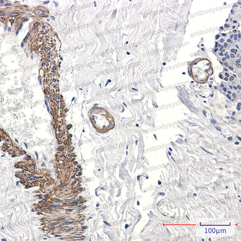 Валидация AntibodySystem RHN81701