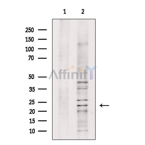 Валидация Affinity DF2480 - 13123