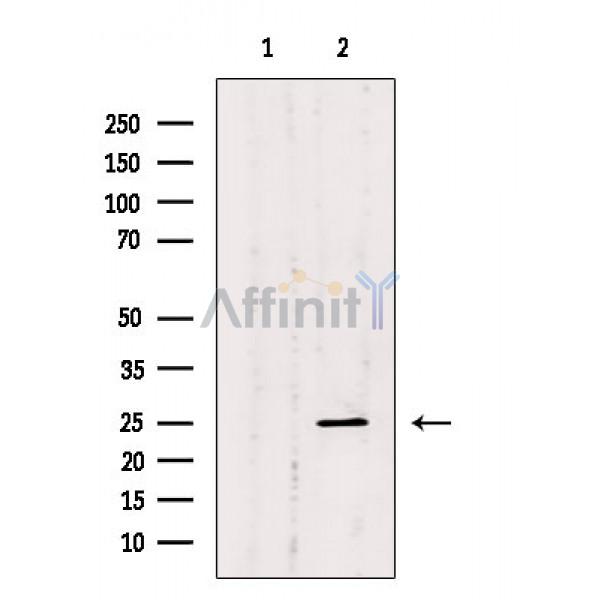 Валидация Affinity DF10188 - 5738
