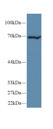 14577