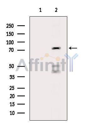 Валидация Affinity DF15351 - 11651