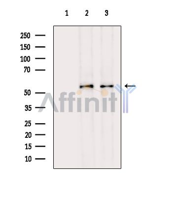 Валидация Affinity DF15498 - 11871