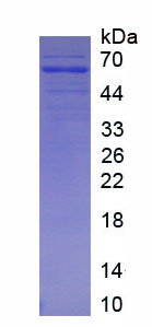 63285
