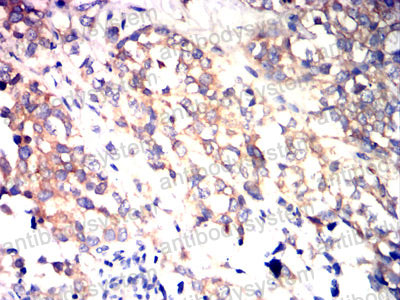 Валидация AntibodySystem RHD08207 (1321)