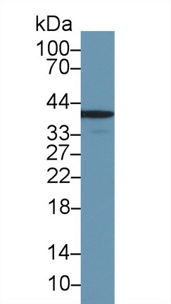 17642