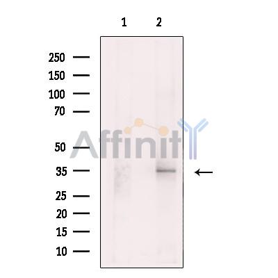 Валидация Affinity DF13614 - 9126