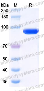 EWC02001, SDS-PAGE