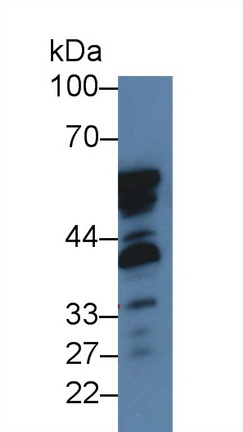 14013