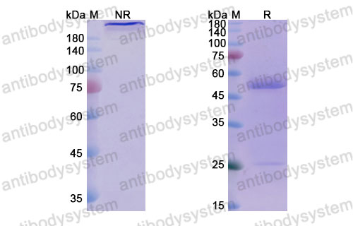 Валидация SDS-PAGE - AntibodySystem DHG01306