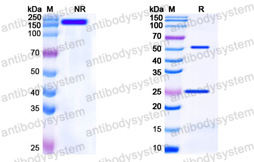 Валидация SDS-PAGE - AntibodySystem FHK18010