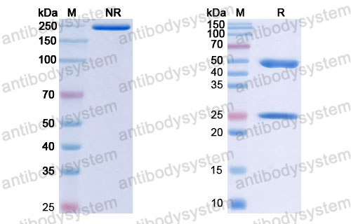 Валидация SDS-PAGE - AntibodySystem RHJ92811