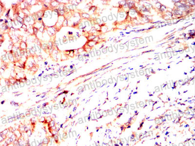 Валидация AntibodySystem RHC06301 (584)