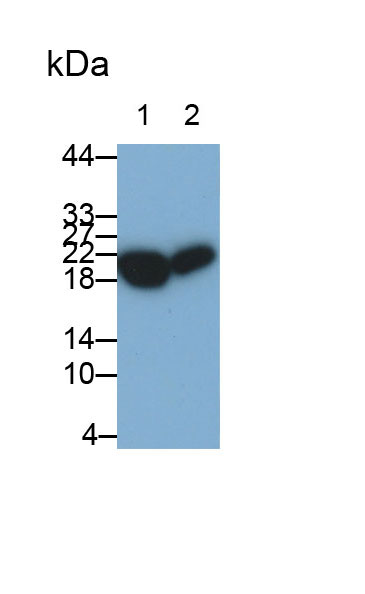 30871