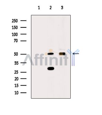 Валидация Affinity DF14874 - 11016