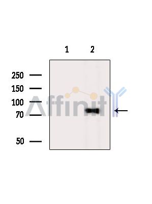 Валидация Affinity DF14892 - 11044