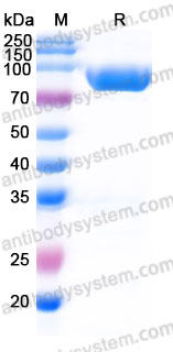AMD19102, SDS-PAGE