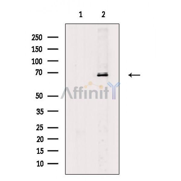 Валидация Affinity DF8519 - 20388