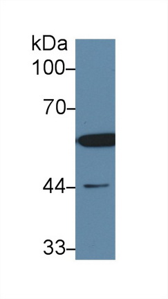 13574