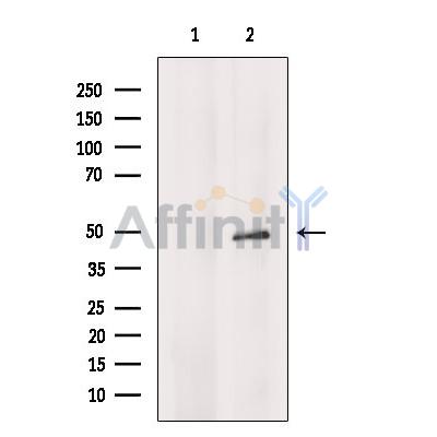 Валидация Affinity DF8524 - 20397
