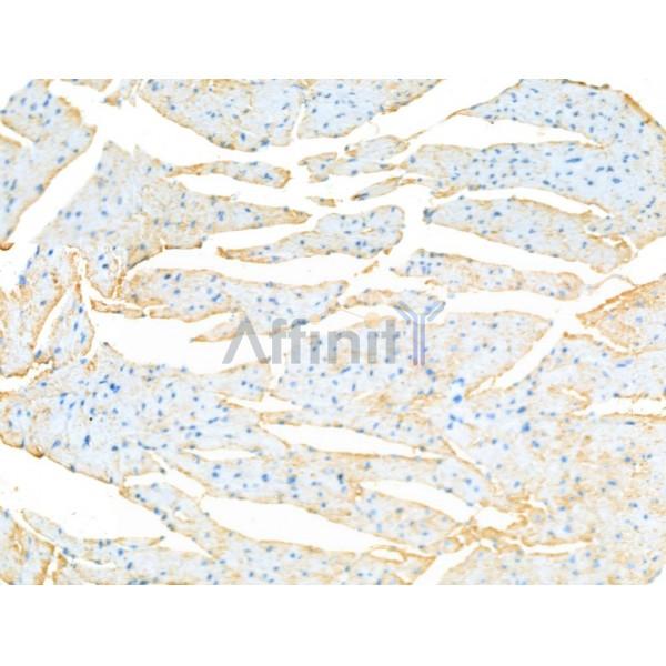 Валидация Affinity DF13339 - 8532