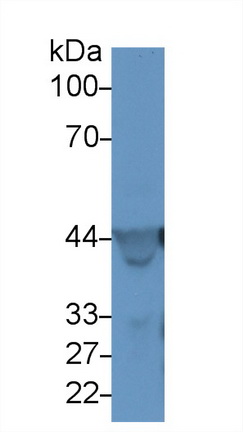 15262