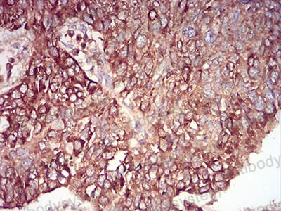 Валидация AntibodySystem RHN95502 (3993)