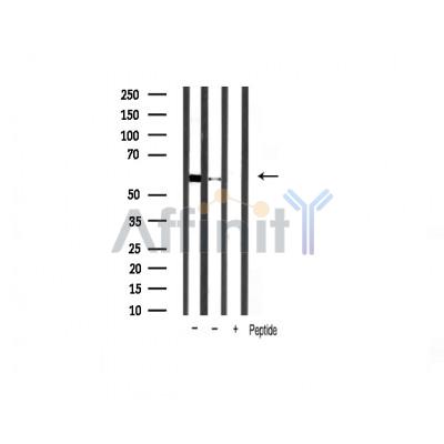 Валидация Affinity AF6264 - 3514