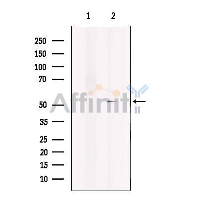 Валидация Affinity DF10339 - 5962