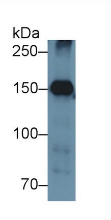 13194