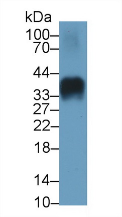 65029