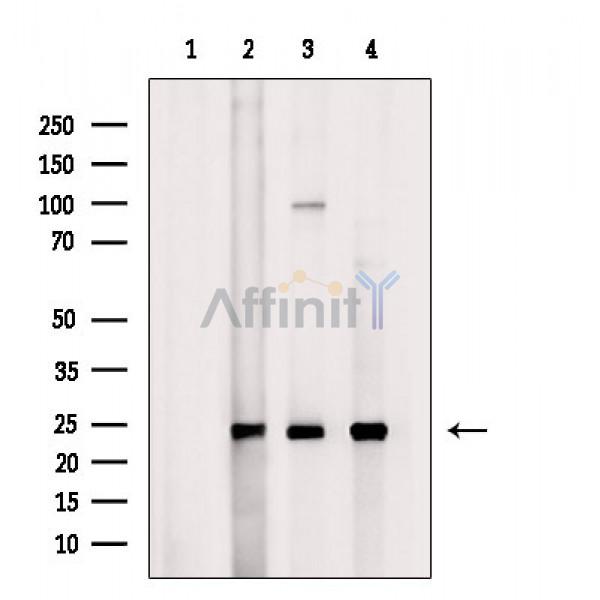 Валидация Affinity DF3651 - 14637